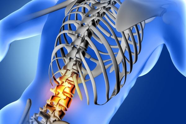 Diagrama columna vertebral y dolor