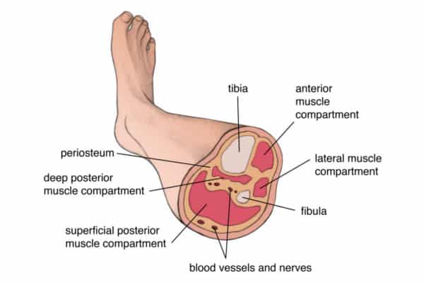 Diagrama compartimentos musculares pierna